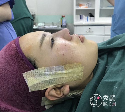北京韩啸整形门诊鼻部手术案例分享。
