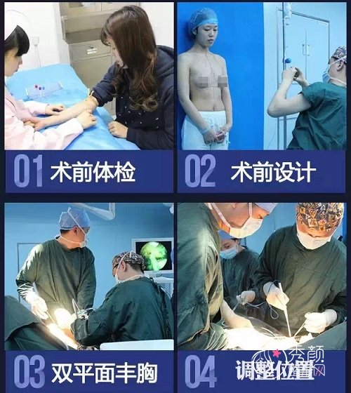 杭州栗勇隆胸技术怎么样|附栗勇隆胸手术前后恢复果对比图