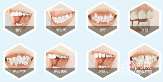 上海哪家医院矫正牙齿比较好？