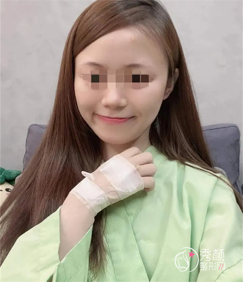 上海做的隆鼻手术，面中凹陷问题终于解决了！