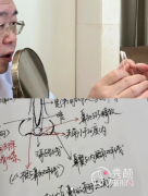 全切双眼皮|割双眼皮