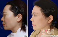 国内十大拉皮名医