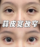 八大处卢建建和王