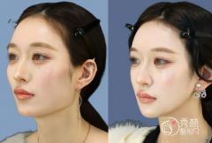 上海磨骨穆雄铮和