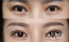 蔡震和游晓波眼修