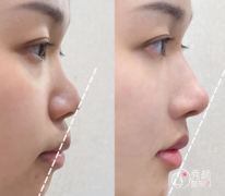 北京鼻修复医生排