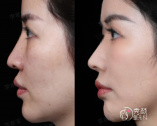 武汉鼻修复医生排