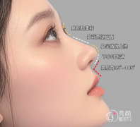 杭州鼻修复医生排