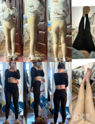 南京吸脂医生排名