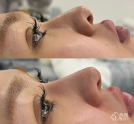 武汉隆鼻医生排名