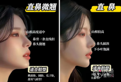 广州隆鼻医生排名