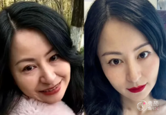 青岛拉皮医生排名