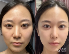 长沙拉皮医生排名