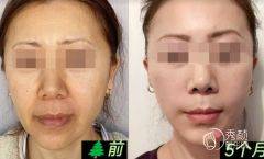 武汉拉皮医生排名