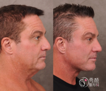 成都拉皮医生排名