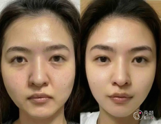 北京拉皮医生排名