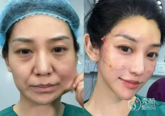 重庆拉皮医生排名