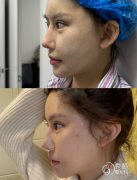 济南拉皮医生排名