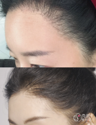 杭州植发医生排名