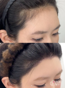 北京植发医生排名