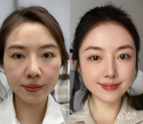 重庆童颜针认证医