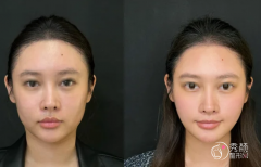 北京童颜针认证医