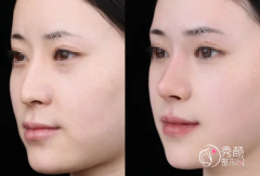 北京爱贝芙认证医