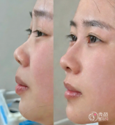 深圳爱贝芙认证医