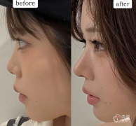 武汉爱贝芙认证医