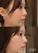 长沙爱贝芙认证医