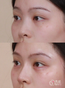 青岛爱贝芙认证医