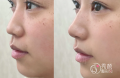 重庆宝尼达认证医