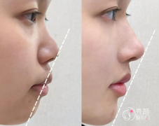 北京宝尼达认证医