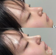 重庆爱贝芙认证医