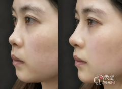 济南爱贝芙认证医