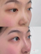 青岛乔雅登认证医