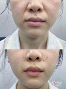 长沙乔雅登认证医