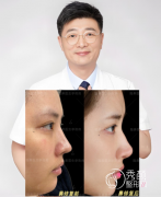 北京隆鼻哪个医生